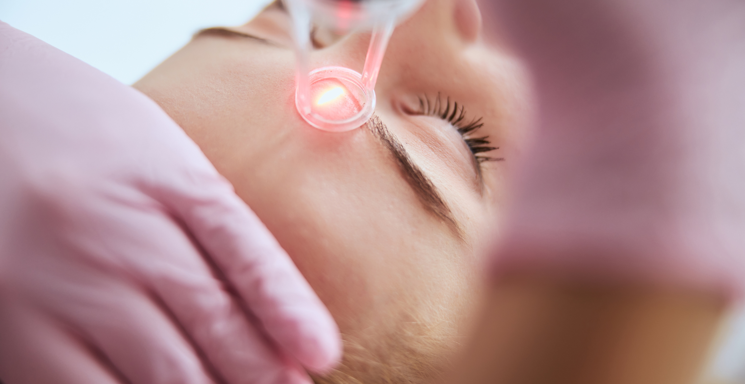 Types Of LASER Treatments in Cosmetic Dermatology