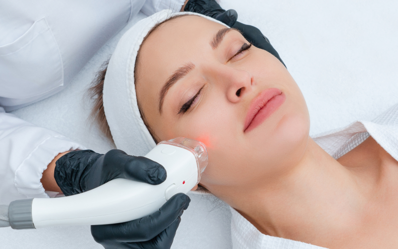 Types of LASER Treatments in Cosmetic Dermatology